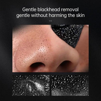 Blackhead Remover Mask - SUPER SALE 🔥60% OFF - Emporium Shop